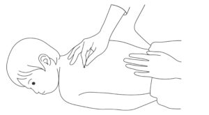 うつ伏せで小児はりを行う様子