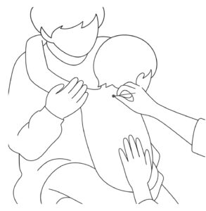 保護者にだっこされた子どもに小児はりを行う様子